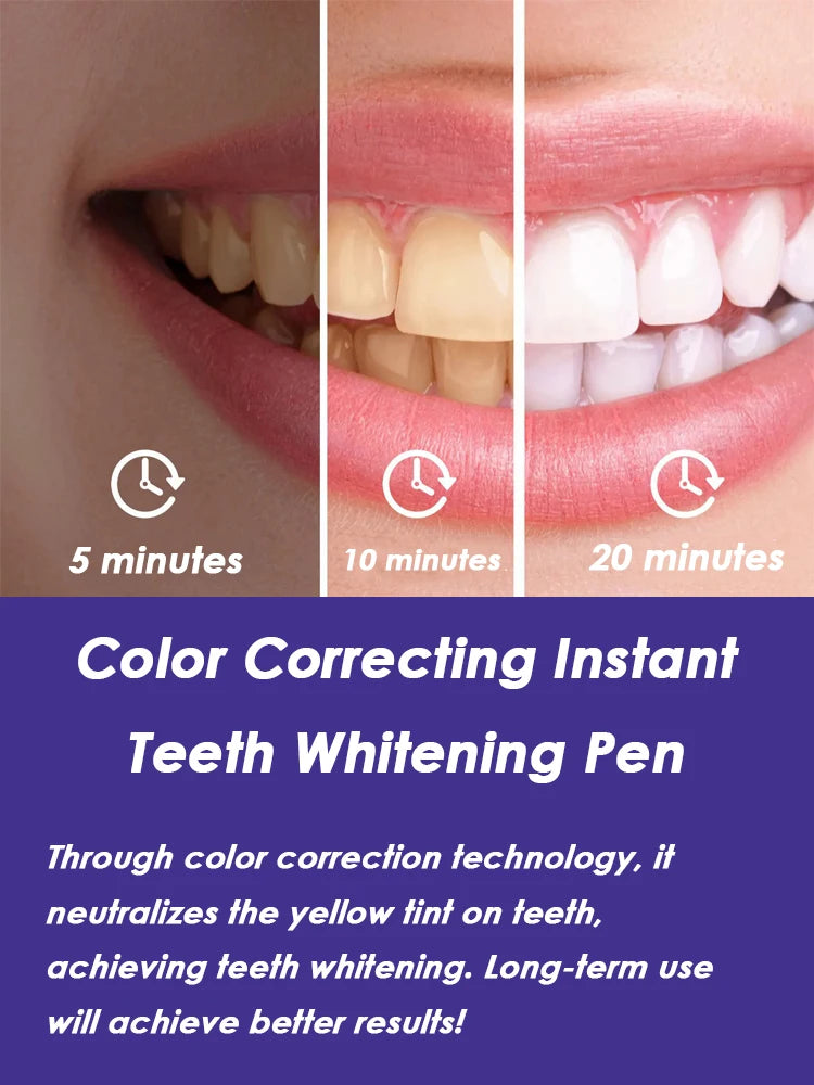 Purple Teeth Whitening Pen